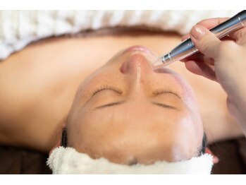 サロン ド ベルペソナ(Salon de bellepersonne)/角栓も黒ずみも一気にケア