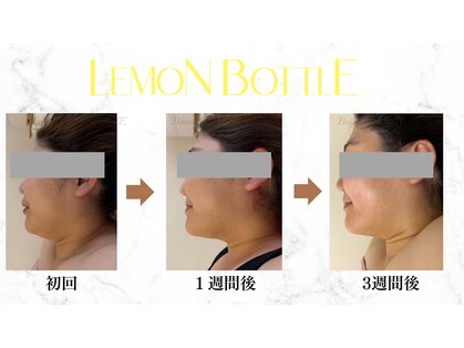 リルチェ 自由が丘(RILUCE)の写真