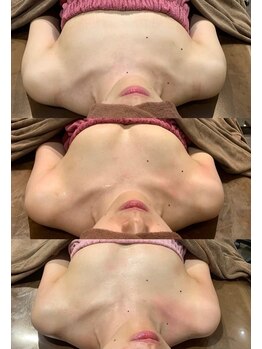 ロココ 豊田店(Rococo)/ビフォーアフター