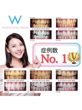 ホワイトニングショップ 本八幡店/ホワイトニング専門店 【市川】