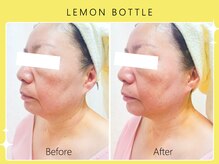 シロカネ 光の森店(SHIROKANE)/レモンボトル☆