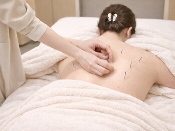 MEGURU 青山 / 表参道店【メグル】美容鍼/小顔/肩こり/リフトアップの写真/「健康な人は、美しい」巡りを整え、本来の自分へ。ライフステージごとに変化するあなたの心身をサポート