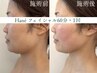 【小顔・たるみ改善】インディバフェイシャル60分｜透明感・ハリUP 13000円→
