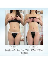 エスプレッソ(espresso,)/【1ヶ所】見た目重視の方必見♪