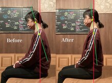 整体院 リアン(Lien)/姿勢改善で肩こりの根本ケア