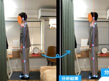 みふく整体院/施術前と施術後の姿勢チェック
