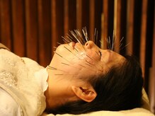 のぐち鍼灸整骨院
