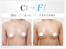 美人バスト 掛川店の雰囲気（豊胸級バストアップ！3カップUPの実績！卒業後も戻らない！）