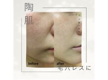 ミロワール ドゥ サピュイェ(MIROIR de Sappuyer)/★毛穴レスに★