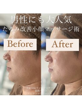 クリニカルホワイトケア 和泉府中店(クリニカルWHITEケア)/男性の方にも大人気！