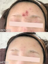 ビアンカ/お客様のお声