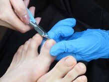 フットケア クラッシー(footcare classy)/分厚い爪もお任せください））