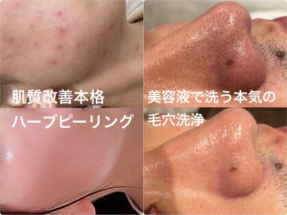 リジュベネ(rejuvena)の写真