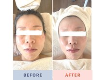 コリ解消でスッキリ小顔に◎ボディ＆フェイシャルが1度で叶う♪