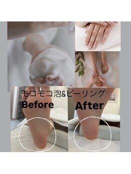 イリゼ(IRISE)/IRISE式/足裏角質フット・ハンド