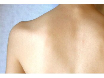 アップパイン(UPPINE)/背中脱毛¥4400/大国町