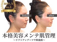 ノーブルノアール(Noble noir)の雰囲気（糸なしでリフトアップ【たるみ矯正】と、ツヤ肌管理を同時に◎）