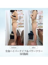 エスプレッソ(espresso,)/【全身痩身】ぽっこりお腹解消！