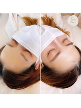 アイル(I'll)/アイビューティをご提案