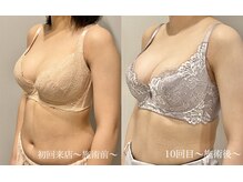 ティアモ(Ti Amo)/Before/After