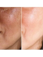 美バリ 新宿店(美BARI)/光フォト＆エアバリ