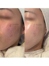 ルブドワール(Le Boudoir)/エンビロントリートメント