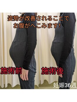 あおい鳥/バキバキしない整体で妊娠期でも