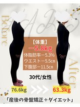ハリス 坂出(HARIS)/３０代/女性 ダイエット成功