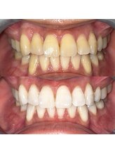 ライトビューティー 池袋店(LightBeauty)/症例写真