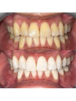 ライトビューティー 池袋店(LightBeauty)/症例写真