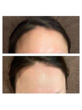 ワックスサロン ジー(waxsalon Gee!)/【お顔×脱毛】