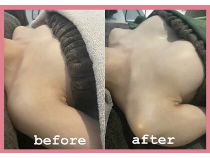 ティアラ(Tiara)の写真