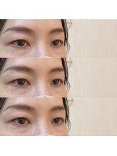 シアミス(SIAMIHS)/まつげパーマ