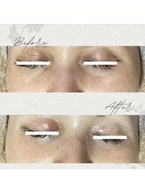 ネリネ(Nerine)/生プラセンタフェイシャル