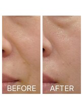 カノン(KANON)/グリーンピール