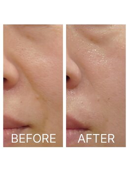 カノン(KANON)/グリーンピール