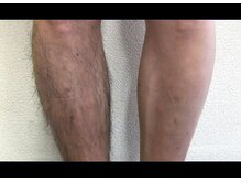 ピービー(PB)の雰囲気（日本エステ協会認定脱毛◎認定脱毛師が圧倒的な脱毛効果を実現◎）