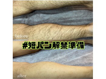 エリクサー 太田店(Elixir)/足脱毛