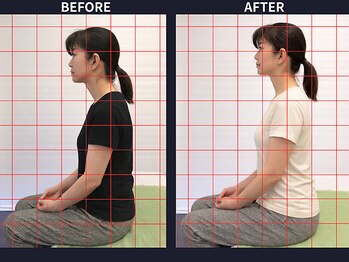 さいとう治療院 新百合ヶ丘/ストレートネック・スマホ首