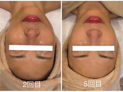 アールユー ギンザ(Ryou ginza)の写真