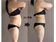 トータルビューティーサロンリア(Li'a)の写真/背中・お腹・二の腕のハミ肉ケアに！キャビテーション&極上リンパマッサージで夏までに理想のボディをGET！