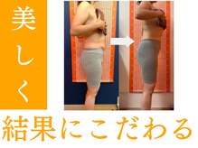【エステ】INDIBA/インディバ痩身プログラム　ビフォーアフター