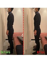 ジェイペック鍼灸整骨院/骨盤矯正【肩こり・腰痛に】