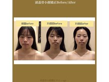 アジール 長岡リバーサイド千秋店(agir)/Before/After画像