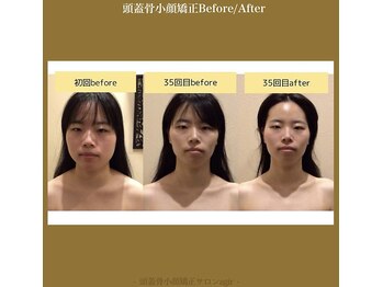 アジール 長岡リバーサイド千秋店(agir)/Before/After画像