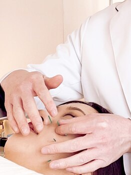アオヤマ サロン ワイゼット(AOYAMA SALON YZ)の写真/【代表は３種類の国家有資格者】自律神経からととのえる美容鍼は通いやすい都度払いサロン◎