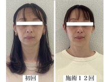 ラボーテヴェリテ(La Beaute Verite)/【お客様施術例】