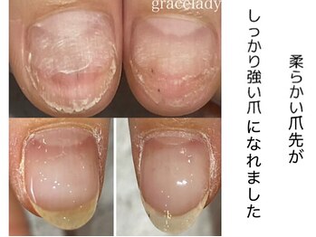 グレースレディ 神戸北店/