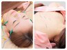 【平日11時～16時限定】美容鍼＋姿勢矯正＋鍼灸の盛沢山★20900→9900円
