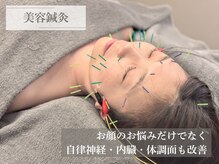 リソラ(RESORA)/美容鍼灸